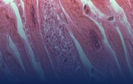 Análise da patogenia da cardiopatia chagásica (CCC) por Biologia de Sistemas. Mitocôndrias, Interferon-gama e genética na cardiopatia chagásica crônica: Patogênese, alvos terapêuticos e marcadores prognósticos